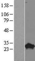 PROP1 Human Over-expression Lysate