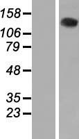 valyl tRNA synthetase (VARS) Human Over-expression Lysate