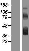Follistatin (FST) Human Over-expression Lysate