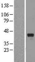 PCID1 (EIF3M) Human Over-expression Lysate