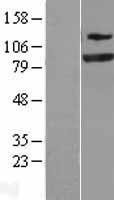 SEC23 (SEC23A) Human Over-expression Lysate