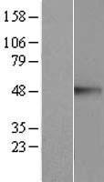 CREB3 Human Over-expression Lysate