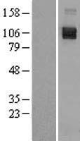 Semaphorin 4D (SEMA4D) Human Over-expression Lysate