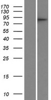 CDRT1 Human Over-expression Lysate