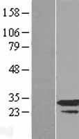 RPP30 Human Over-expression Lysate