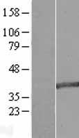 MAB21L2 Human Over-expression Lysate
