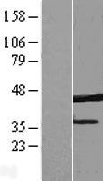 ERLIN1 Human Over-expression Lysate