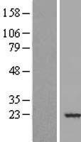 MRCL3 (MYL12A) Human Over-expression Lysate