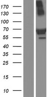 TRIM16 Human Over-expression Lysate