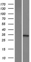 ketohexokinase (KHK) Human Over-expression Lysate