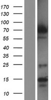 DYRK1B Human Over-expression Lysate