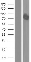 DYRK1B Human Over-expression Lysate