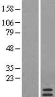 SAA4 Human Over-expression Lysate