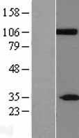 CLCA2 Human Over-expression Lysate