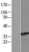 RRAGA Human Over-expression Lysate