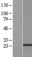 Securin 2 (PTTG2) Human Over-expression Lysate