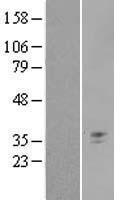 KLRA1 (KLRA1P) Human Over-expression Lysate