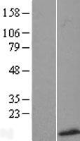 SMR3B Human Over-expression Lysate