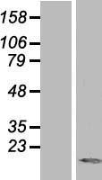TXNL4A Human Over-expression Lysate