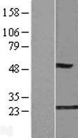 GLO1 Human Over-expression Lysate