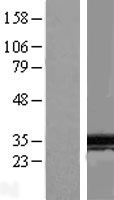 spindlin 1 (SPIN1) Human Over-expression Lysate