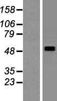 SMPDL3A Human Over-expression Lysate
