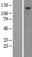 ITPRID2 Human Over-expression Lysate