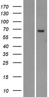 UGT2A1 Human Over-expression Lysate
