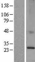 KDEL Receptor (KDELR1) Human Over-expression Lysate