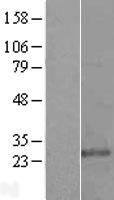 KDELR3 Human Over-expression Lysate