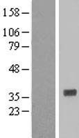 HNMT Human Over-expression Lysate
