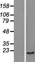 SKP1 Human Over-expression Lysate
