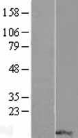 RPP14 Human Over-expression Lysate