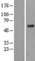 ATE1 Human Over-expression Lysate
