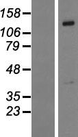PTPD1 (PTPN21) Human Over-expression Lysate