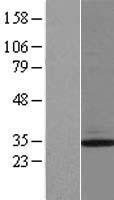 Clathrin light chain (CLTB) Human Over-expression Lysate
