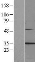 Clathrin light chain (CLTA) Human Over-expression Lysate