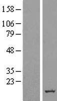 ERG28 (C14orf1) Human Over-expression Lysate