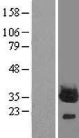PLPBP Human Over-expression Lysate