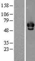 Chk2 (CHEK2) Human Over-expression Lysate