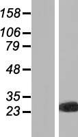 PXMP4 Human Over-expression Lysate