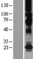 CHIC2 Human Over-expression Lysate