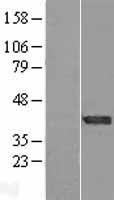Carbonic Anhydrase XIV (CA14) Human Over-expression Lysate