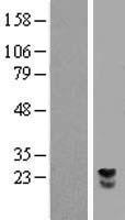LRRC29 Human Over-expression Lysate