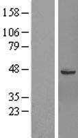 GTPBP6 Human Over-expression Lysate