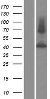 P2X2 (P2RX2) Human Over-expression Lysate