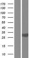 TPSD1 Human Over-expression Lysate