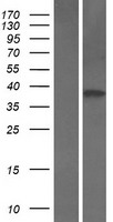 ITGB1BP2 Human Over-expression Lysate