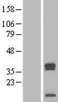 TRAM2 Human Over-expression Lysate