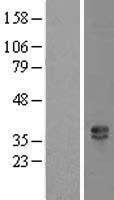 KIR2DS3 Human Over-expression Lysate